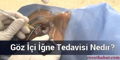 Göz İçi İğne Tedavisi