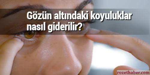 Gözün altındaki morluklar nasıl geçer Gözün altındaki morluklar nasıl geçer
