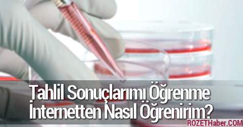 Tahlil Sonuçları Nasıl Nereden Bakılır Tahlil Sonuçları Nasıl Nereden Bakılır